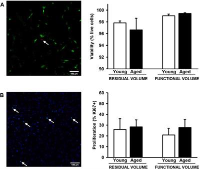 Effects of aging on the biomechanical properties of the lung extracellular matrix: dependence on tissular stretch